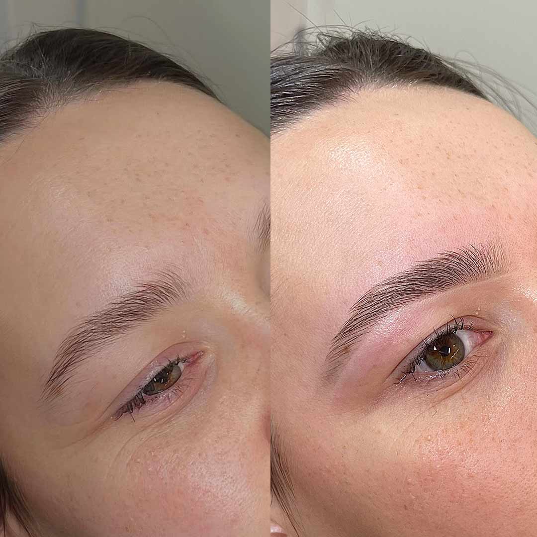 Before & After by Amie Speller