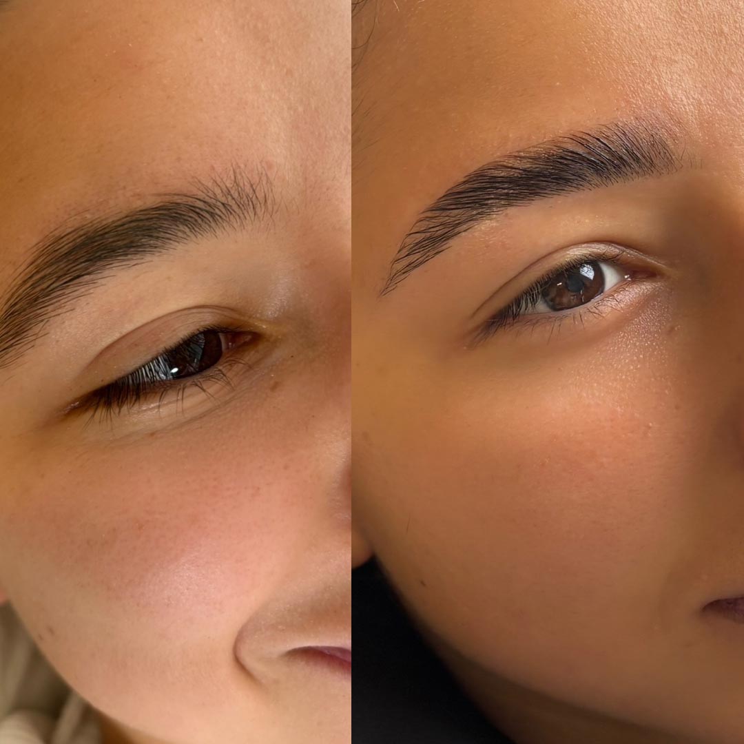 Before & After by Amy Burvill