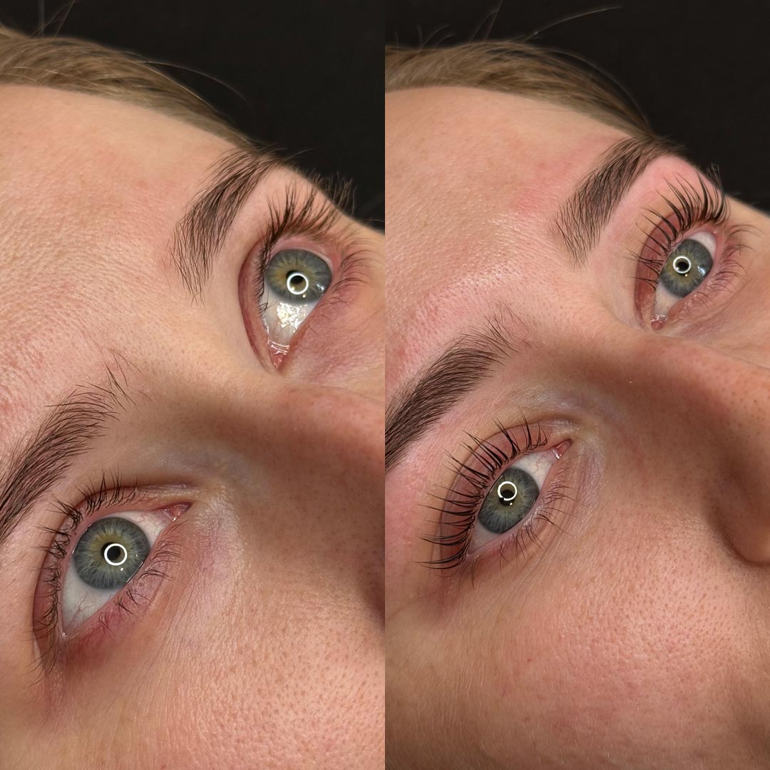 Before & After by Beckii Lancey