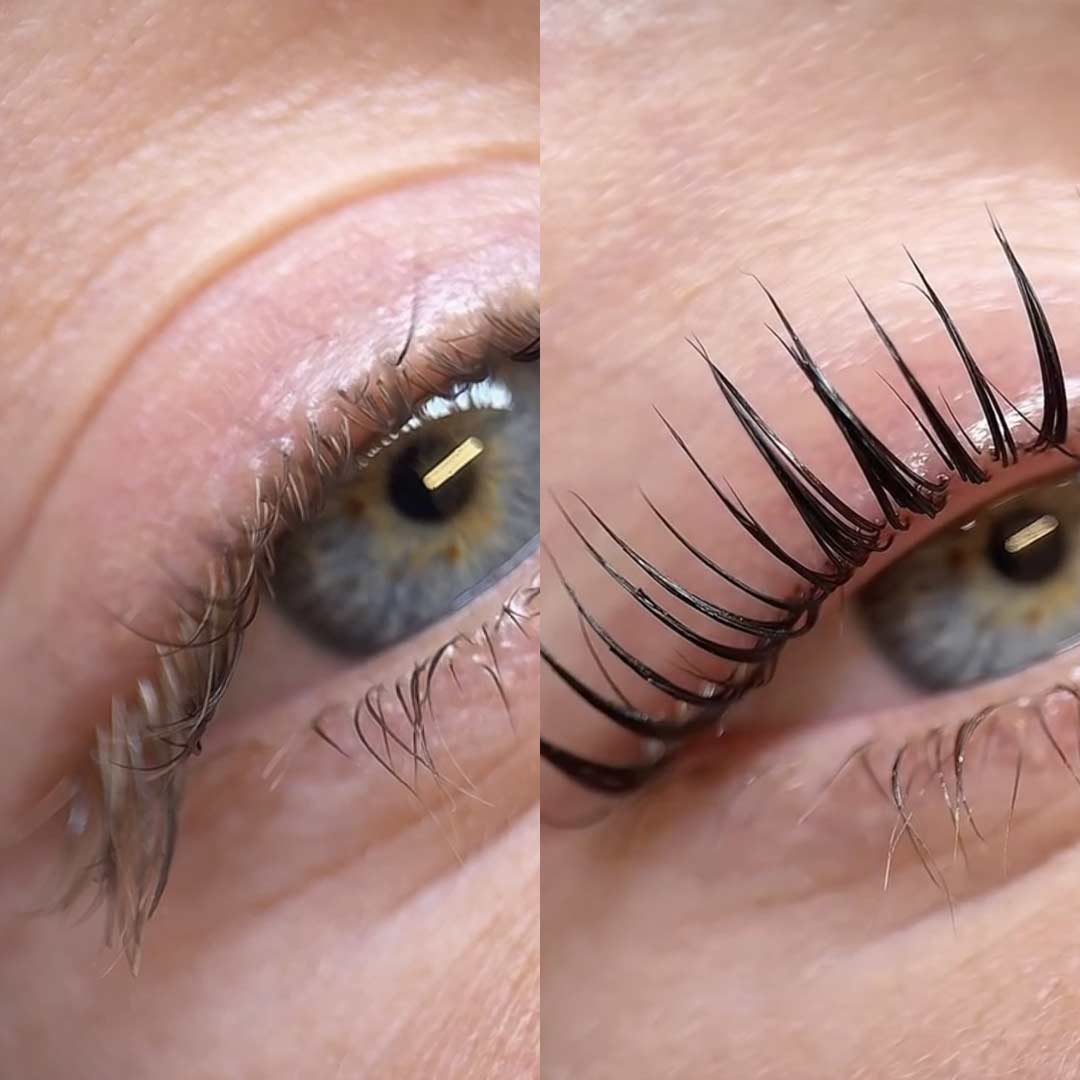 Before & After by Emily Coburn