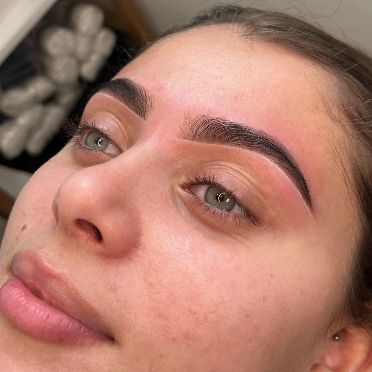 Before & After by Emily Rhodes