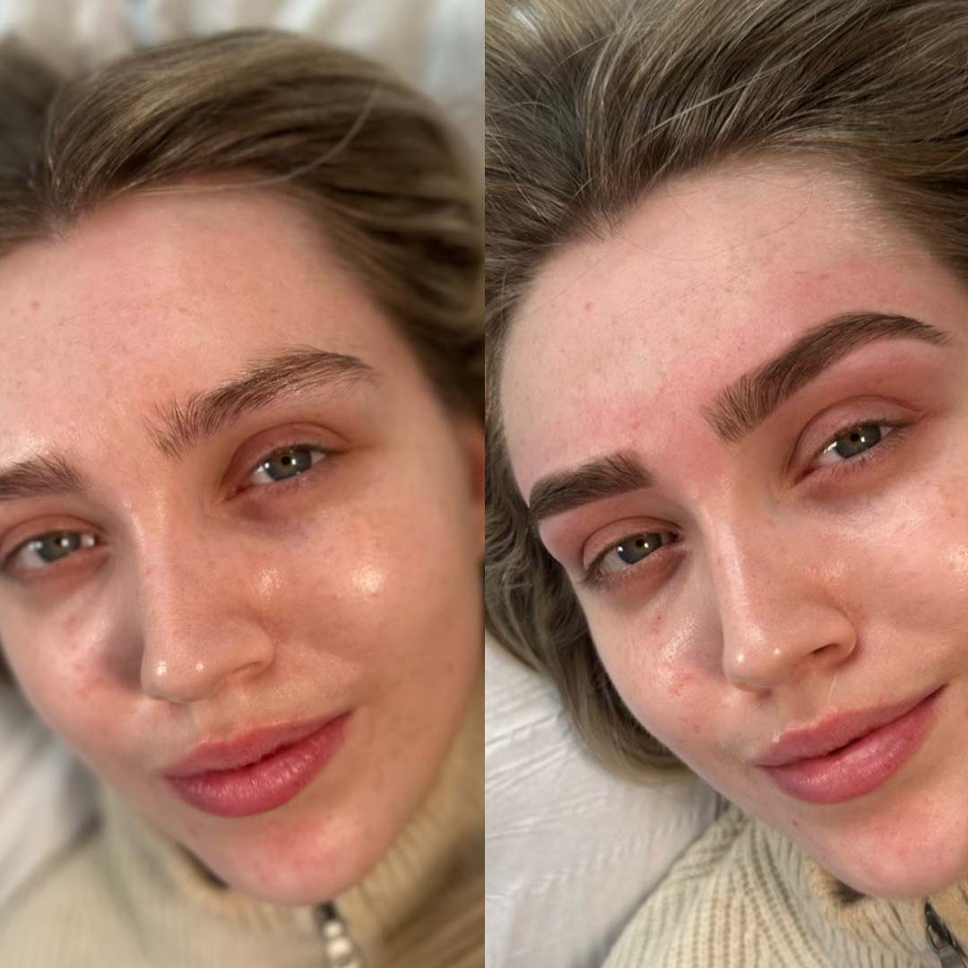 Before & After by Gráinne Frawley