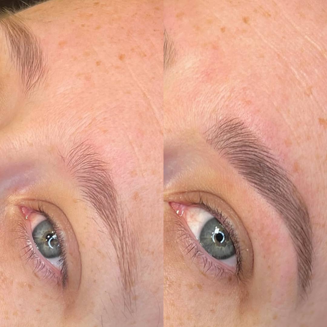 Before & After by Harriet Thacker