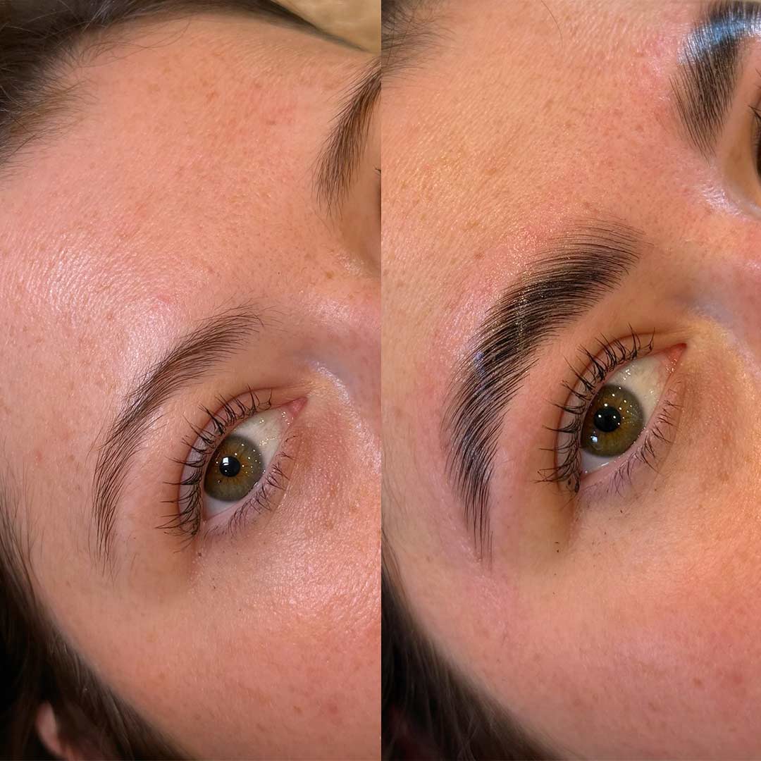 Before & After by Jamilla Arkell