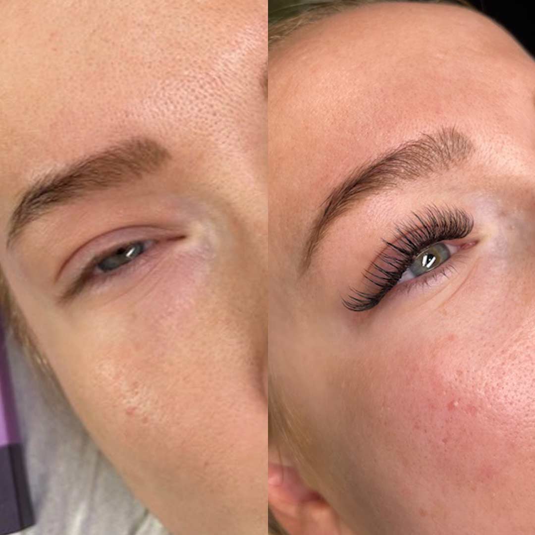 Before & After by Jessica Foster Miles