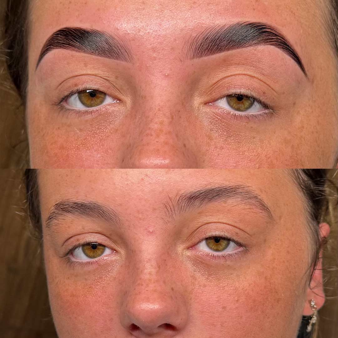 Before & After by Joanne Febers