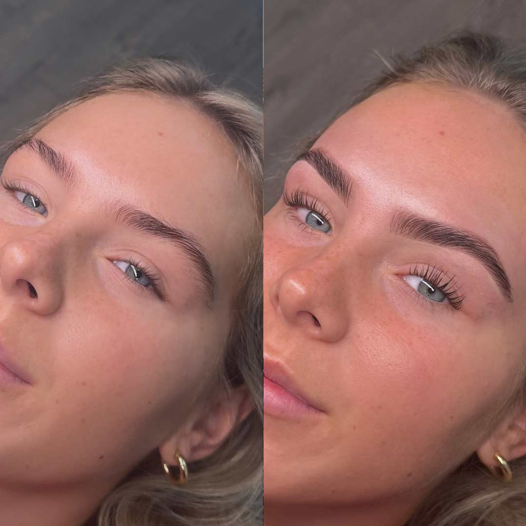 Before & After by Lauren Brocklehurst
