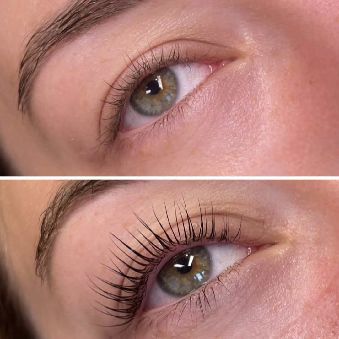 Before & After by Lauren Downey