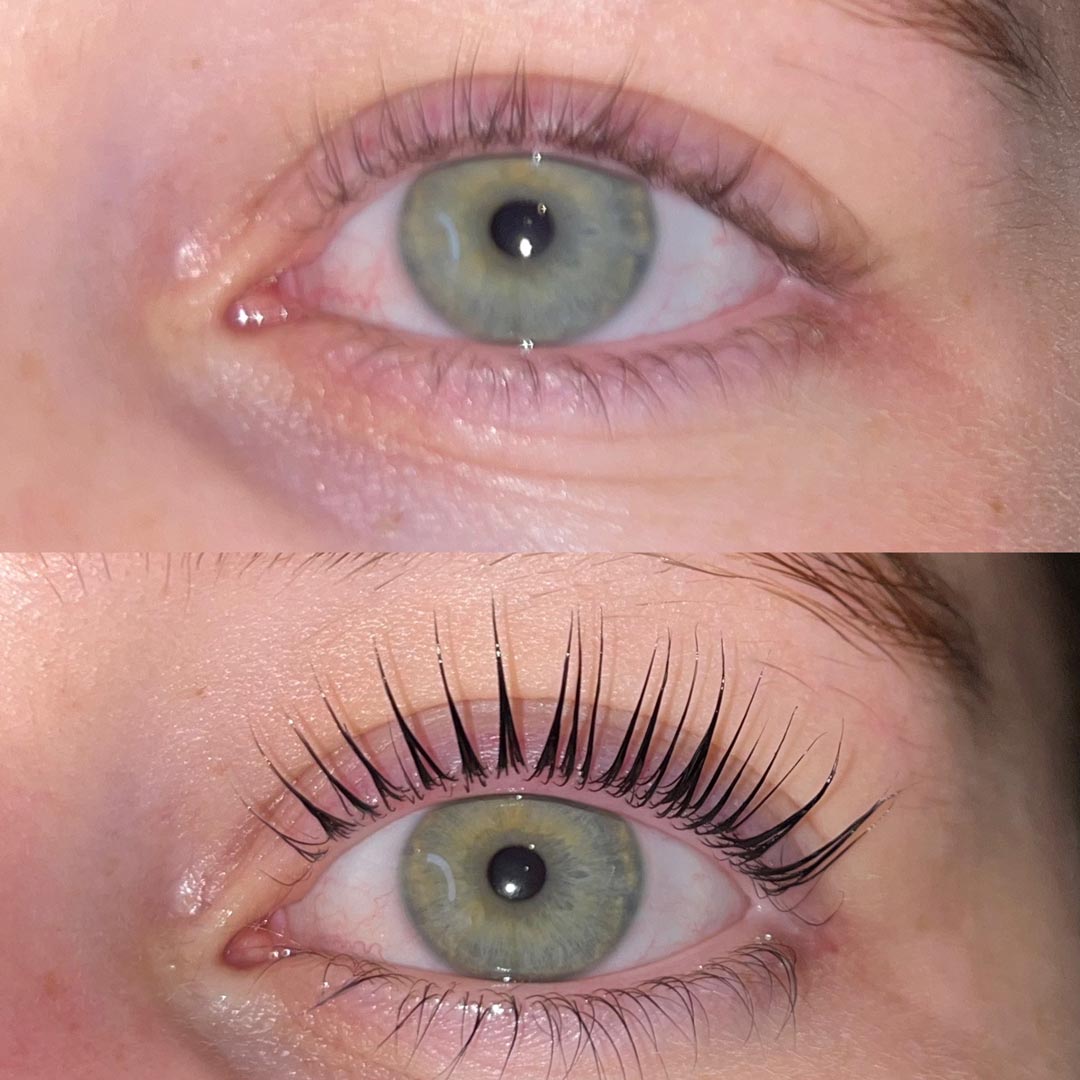 Before & After by Millie Campbell