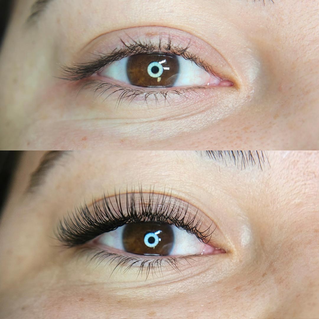Before & After by Nicole Huggins
