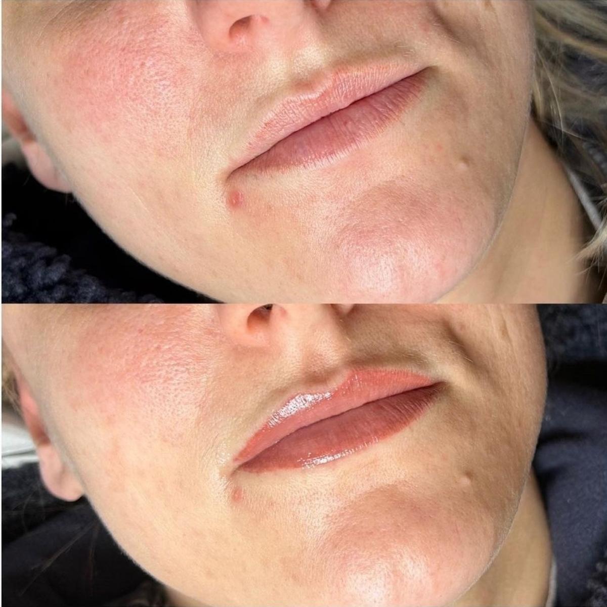 Before and after image of lip blush