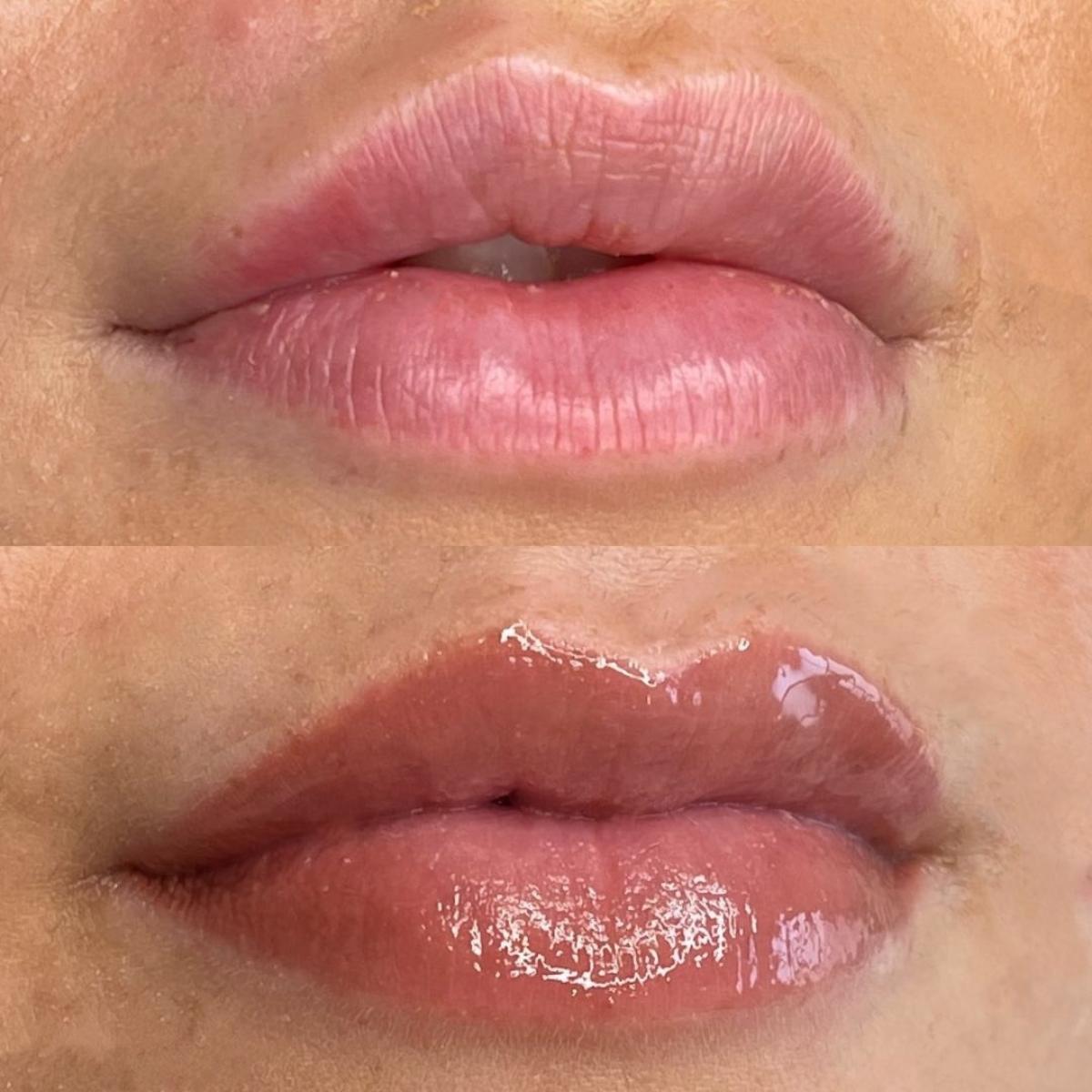 Before and healed results of a lip blush treatment