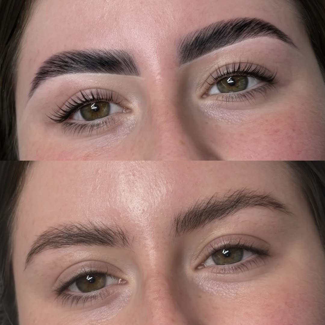 Before & After by Rhe Dale