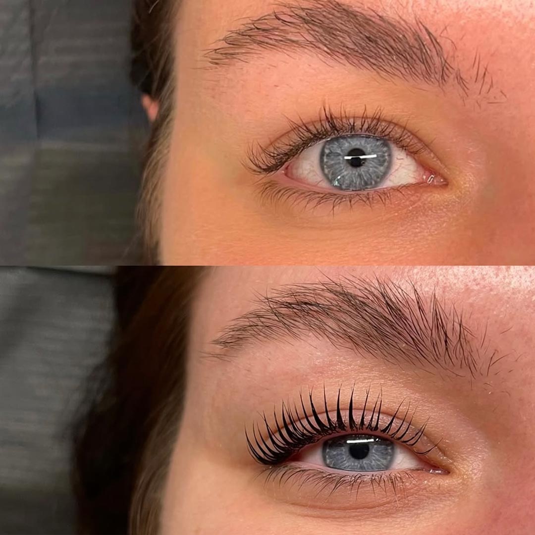 Before & After by Atlanta Regan